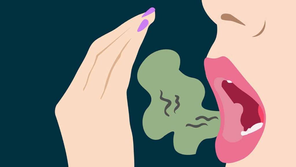 Halitosis - Causes and Treatment