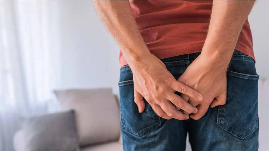 Hemorrhoids-Symptoms-and-Treatment