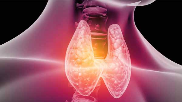 Hypothyroidism