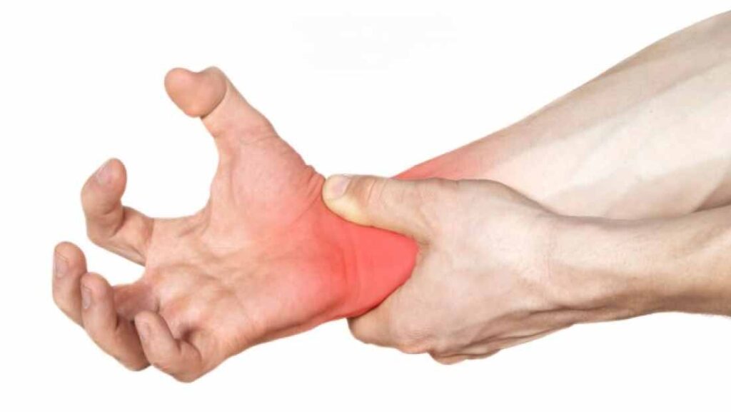 carpal tunnel syndrome